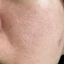 ポテンツァ 大美会クリニック 岡山院 DAY 2 サムネイル用