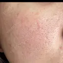 ポテンツァ 大美会クリニック 岡山院 DAY 3 サムネイル用