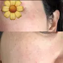 スネコス Natural Skin Clinic 自由ヶ丘院 DAY 0 サムネイル用