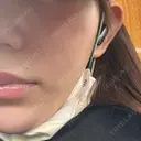 水光注射（ハリ・美肌） CHARIS BEAUTY CLINIC DAY 0 サムネイル用