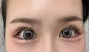 目尻切開 / タレ目形成・グラマラスライン（切開） BIANCA銀座 DAY 10 サムネイル用