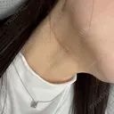 ボトックス（エラ・小顔） / RF（高周波）たるみ治療 大美会クリニック 梅田院 DAY 4 サムネイル用