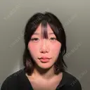 ヒアルロン酸注入（涙袋） / ヒアルロン酸注入（鼻） / ヒアルロン酸注入（あご） / ヒアルロン酸注入（唇） / ヒアルロン酸注入（頬） / ボトックス（肩） / ヒアルロン酸注入（鼻翼基部） HAAB×DREAM BEAUTY CLINIC 大阪梅田院 AFTER サムネイル用