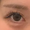 ヒアルロン酸注入（涙袋） フィラークリニック 大阪心斎橋院 DAY 0 サムネイル用