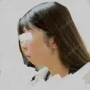 ハイフ（顔） 表参道メディカルクリニック 名古屋院 DAY 15 サムネイル用