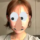 ハイフ（顔） HINATA クリニック AFTER サムネイル用