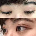 二重切開 / 目頭切開 / ほくろ・いぼ切除（肌） / 上まぶたたるみ取り / 上まぶたの脂肪取り 東京美容外科 銀座院 DAY 54 サムネイル用
