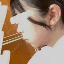 ハイフ（顔） 表参道メディカルクリニック 名古屋院 DAY 25 サムネイル用