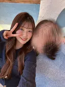 糸リフト / 脂肪吸引（顔） / ジョールファット除去 / ヒアルロン酸注入（あご） / ボトックス（エラ・小顔） 新宿美容外科ネビュラクリニック DAY 7 サムネイル用