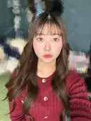 糸リフト / 脂肪吸引（顔） / ジョールファット除去 / ヒアルロン酸注入（あご） / ボトックス（エラ・小顔） 新宿美容外科ネビュラクリニック DAY 12 サムネイル用