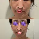 オリジオ PRISM Beauty Clinic 新宿院 DAY 0 サムネイル用