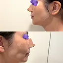 オリジオ PRISM Beauty Clinic 新宿院 DAY 0 サムネイル用