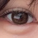 ヒアルロン酸注入（涙袋） ルラ美容クリニック 渋谷本院 AFTER サムネイル用