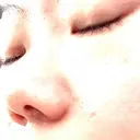 肌ヒアルロン酸注入（たるみ・シワ改善） 博多美容外科/美容皮膚科 ビラビューティークリニック DAY 2 サムネイル用