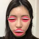 鼻尖形成（切開） / 小鼻縮小（切開） / その他（鼻） / 骨切幅寄せ / ワシ鼻修正・ハンプ切除 / 鼻尖縮小 ザ・プラス美容外科 DAY 61 サムネイル用