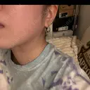 ボトックス（エラ・小顔） 新未来クリニック AFTER サムネイル用