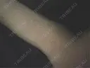 白玉点滴・注射 シン・整形外科 綱島 AFTER サムネイル用