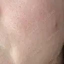 ポテンツァ 大美会クリニック 岡山院 DAY 8 サムネイル用