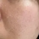 ポテンツァ 大美会クリニック 岡山院 DAY 8 サムネイル用