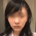 バッカルファット除去 / 脂肪吸引（顔） / ヒアルロン酸注入（鼻） / ボトックス（あご） / 水光注射（ハリ・美肌） / ボトックス（エラ・小顔） / ボトックス（口角） / 白玉点滴・注射 エートップ美容整形外科 AFTER サムネイル用