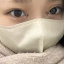 目頭切開 新宿美容外科ネビュラクリニック DAY 0 サムネイル用