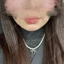 ボトックス（エラ・小顔） / RF（高周波）たるみ治療 大美会クリニック 梅田院 AFTER サムネイル用