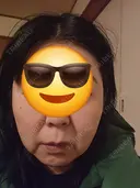 デンシティ 湘南美容クリニック 松戸院 AFTER サムネイル用