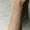 医療脱毛（顔） / 医療脱毛（全身） おおかみ美容のクリニック 横浜院 DAY 0 サムネイル用