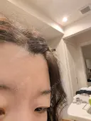 再生医療 A CLINIC（エークリニック） 新宿院 DAY 0 サムネイル用