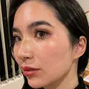 ヒアルロン酸注入（鼻） / ヒアルロン酸注入（鼻翼基部） HAAB×DREAM BEAUTY CLINIC 大阪梅田院 DAY 0 サムネイル用