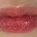 ヒアルロン酸注入（涙袋） / ヒアルロン酸注入（鼻） / ヒアルロン酸注入（あご） / ボトックス（エラ・小顔） / ヒアルロン酸注入（唇） / ヒアルロン酸注入（頬） HAAB×DREAM BEAUTY CLINIC 大阪梅田院 DAY 18 サムネイル用