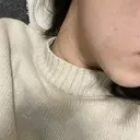 ハイフ（顔） 表参道メディカルクリニック 福岡天神院 AFTER サムネイル用