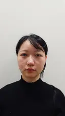 ヒアルロン酸注入（涙袋） / ヒアルロン酸注入（鼻） / ボトックス（あご） / ヒアルロン酸注入（あご） HAAB×DREAM BEAUTY CLINIC 大阪梅田院 AFTER サムネイル用