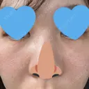 リジュラン Natural Skin Clinic 自由ヶ丘院 AFTER サムネイル用