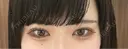 二重埋没 TCB東京中央美容外科 奈良院 AFTER サムネイル用