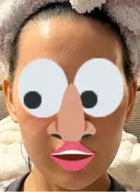 インモード PureMe Skin Clinic（ピュアミースキンクリニック麻布） DAY 2 サムネイル用