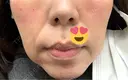 ジャルプロ ゆきスキンクリニック 東池袋 DAY 0 サムネイル用