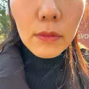 オンダリフト RIVER CLINIC（リバークリニック） DAY 1 サムネイル用