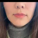 オンダリフト RIVER CLINIC（リバークリニック） AFTER サムネイル用
