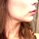 ボトックス（あご） / ボトックス（エラ・小顔） DMTC CLINIC 渋谷院 AFTER サムネイル用