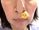 ジャルプロ ゆきスキンクリニック 東池袋 DAY 2 サムネイル用