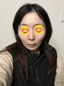 ソフウェーブ アンリクリニック 名古屋院 DAY 2 サムネイル用