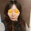 ソフウェーブ アンリクリニック 名古屋院 DAY 7 サムネイル用