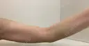 その他（輪郭） 美容皮膚科エルムクリニック 大阪院 DAY 38 サムネイル用