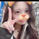 二重埋没 / 二重切開 / 目頭切開 / 上まぶたたるみ取り / 上まぶたの脂肪取り 新宿美容外科ネビュラクリニック AFTER サムネイル用