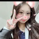 二重埋没 / 二重切開 / 目頭切開 / 上まぶたたるみ取り / 上まぶたの脂肪取り 新宿美容外科ネビュラクリニック DAY 9 サムネイル用