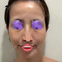 オリジオ PRISM Beauty Clinic 新宿院 DAY 17 サムネイル用