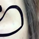 ボトックス（目尻） / ボトックス（額） / その他（目元） 共立美容外科 名古屋院 AFTER サムネイル用