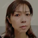 インモード / オンダリフト RIVER CLINIC（リバークリニック） DAY 1 サムネイル用