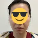 糸リフト / 肌育注射（ジュベルックなど） 東京ココセランクリニック DAY 8 サムネイル用